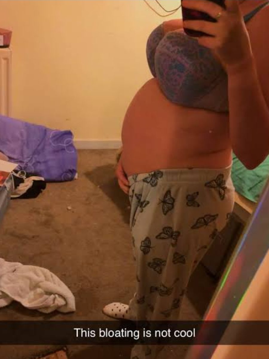 Woman showing her bloated stomach