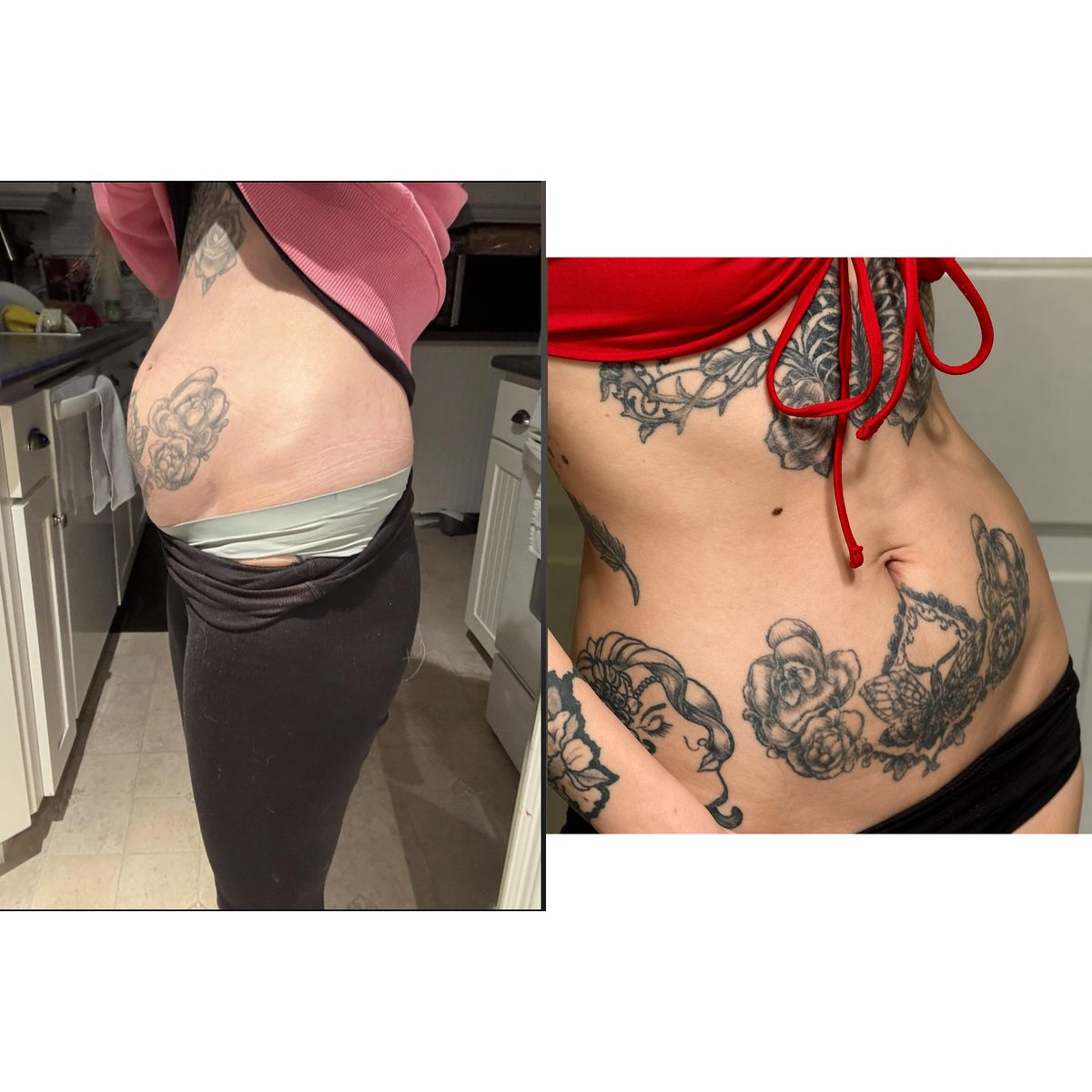 Before and after photo