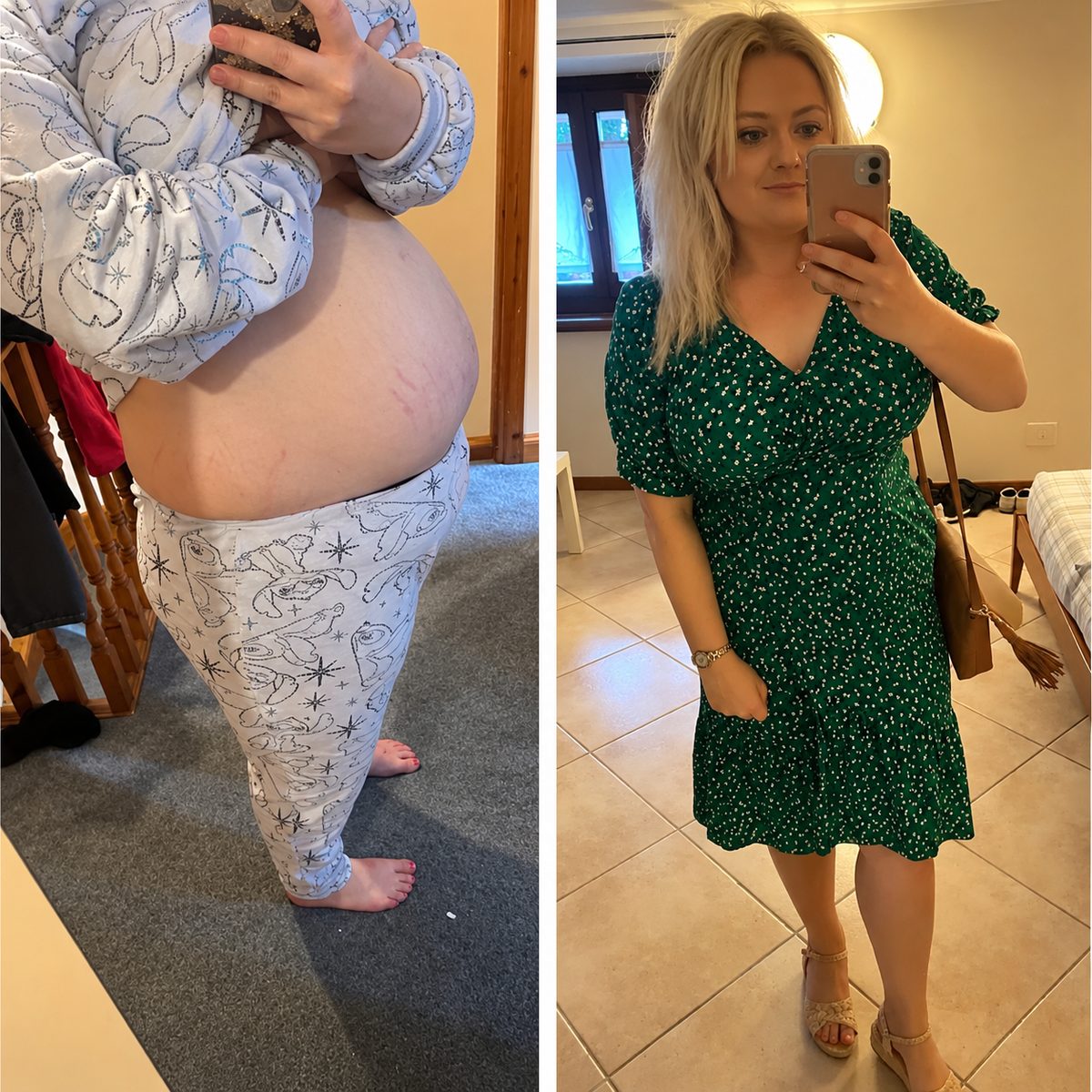 Before and after photo