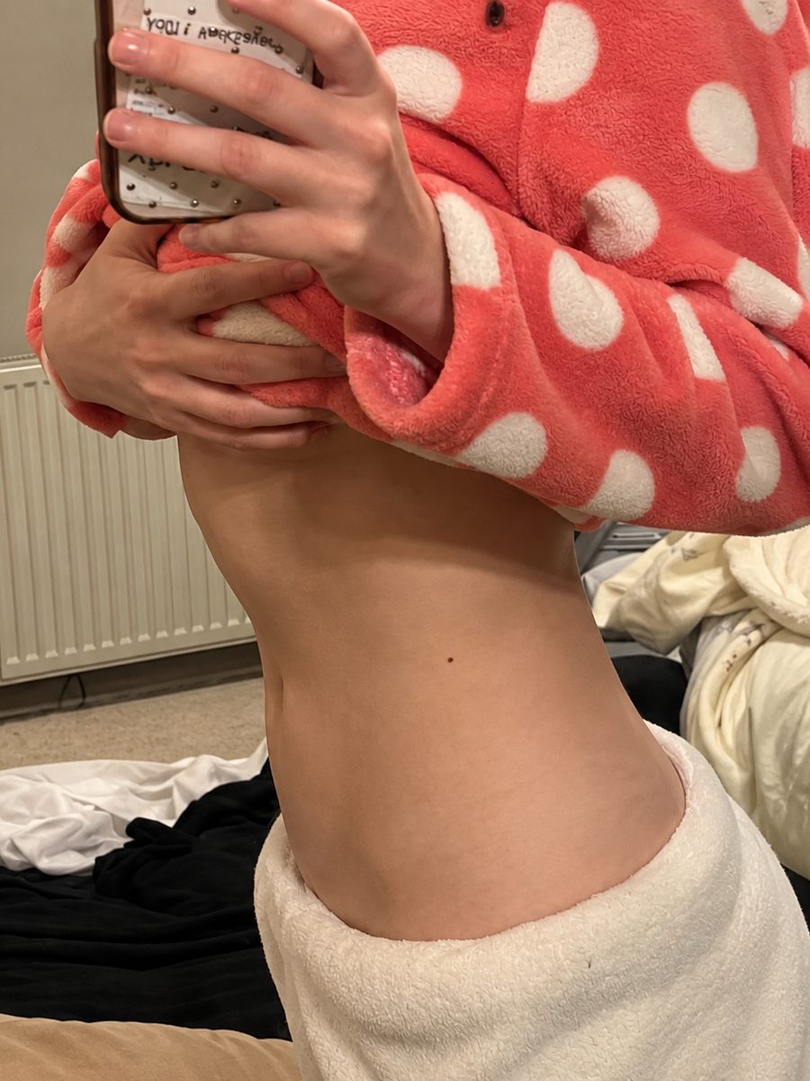 Woman showing her bloated stomach
