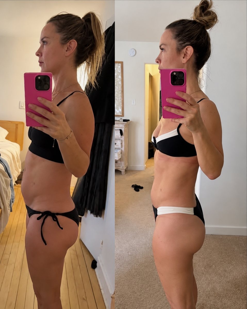 Before and after photo
